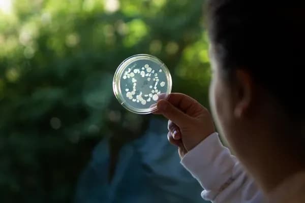 Bir kişi, üzerinde mikroorganizma kolonileri bulunan şeffaf bir petri kabını ışığa doğru tutarak inceliyor.